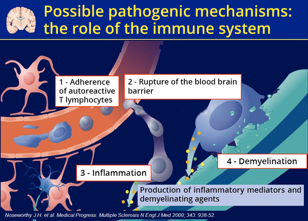 Possible pathogenic mechanisms in multiple sclerosis